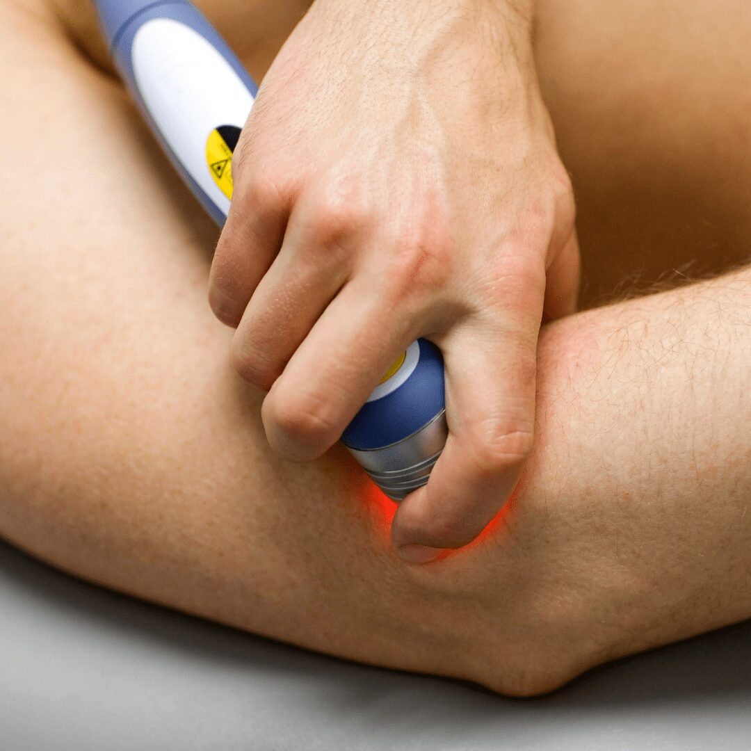Laser Therapy on Elbow